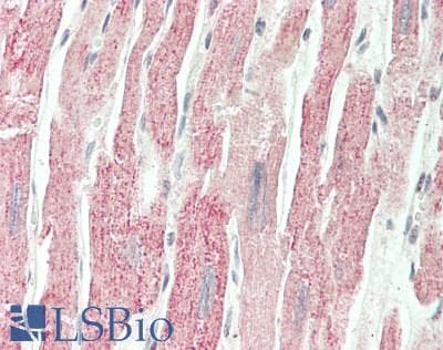 IHC-plus™ Polyclonal Rabbit anti-Human PPARA / PPAR Alpha Antibody (IHC, WB)