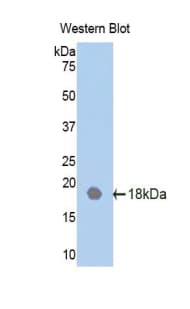 AcPL / IL18RAP Antibody (aa117-240)