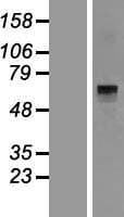 HAL / Histidine Ammonium Lyase Protein (Over-Expression Lysate Myc-DDK (Flag))