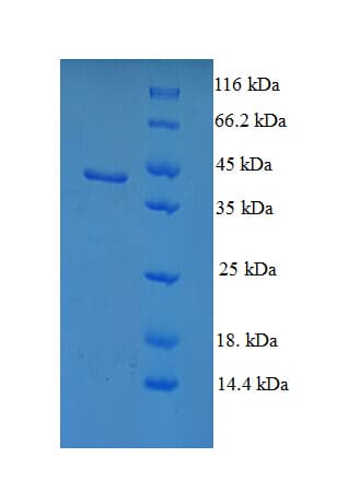 Human SCP2 / SCPX Protein (Recombinant GST)