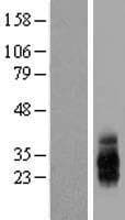 TIGIT Protein (Over-Expression Lysate Myc-DDK (Flag))