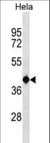 TSEN2 Antibody (aa16-43)
