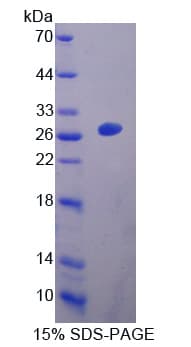 Mouse EBI3 / IL-27B Protein (Recombinant His-T7)