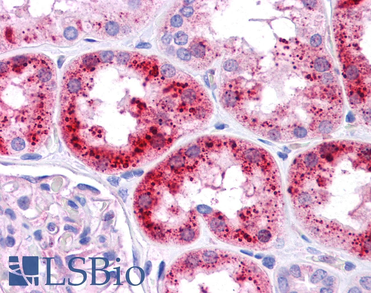 EMA / MUC1 Antibody (aa38-87)