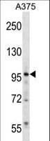 ZNF541 Antibody (aa737-765)