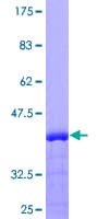 Human UMOD / Uromodulin Protein (Recombinant GST, N-terminus)