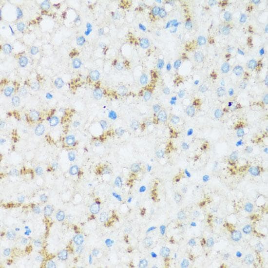 Polyclonal Rabbit anti-Human APOD / Apolipoprotein D Antibody (IHC)