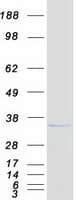 Human CTDSP1 / SCP1 Protein (Recombinant Myc-DDK (Flag))
