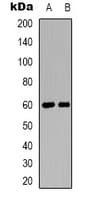 Polyclonal Rabbit anti-Human CAT / Catalase Antibody (C-Terminus, WB)