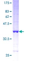 Human HBE1 / Hemoglobin Epsilon 1 Protein (Recombinant GST)