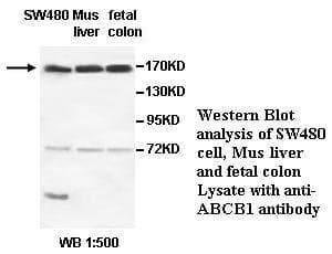 ABCB1 / MDR1 / P Glycoprotein Antibody