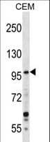 GREB1 Antibody (aa1417-1446)