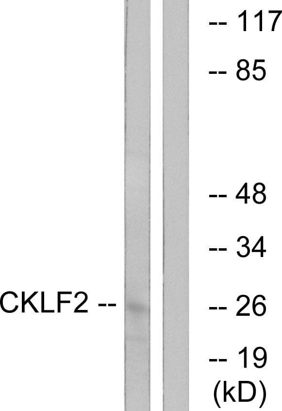 CMTM2 Antibody
