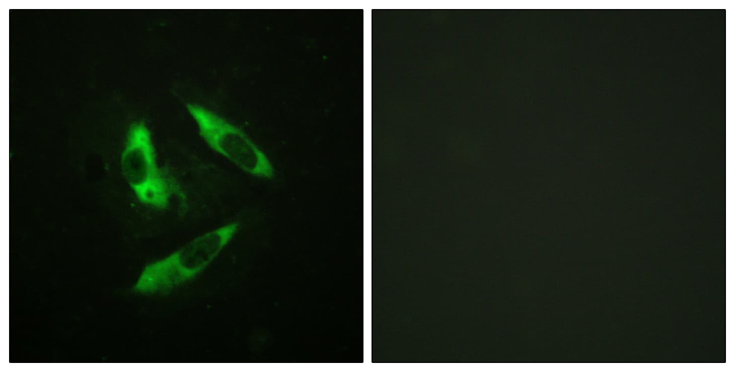 Polyclonal Rabbit anti-Human RPH3A / Rabphilin 3A Antibody (phospho-Ser237, IHC, IF, WB)
