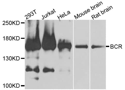 Polyclonal Rabbit anti-Human CML / BCR Antibody (IHC, WB)