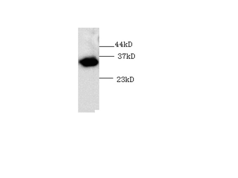 Monoclonal Mouse Thioredoxin / TRX Tag Antibody (aa1-111, WB)