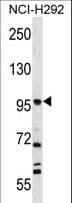 FAP Alpha Antibody