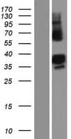 ZC3H14 Protein (Over-Expression Lysate Myc-DDK (Flag))