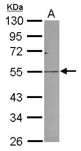 PV1 / PLVAP Antibody