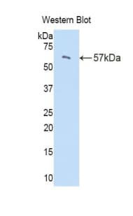 PI16 Antibody (aa21-468)