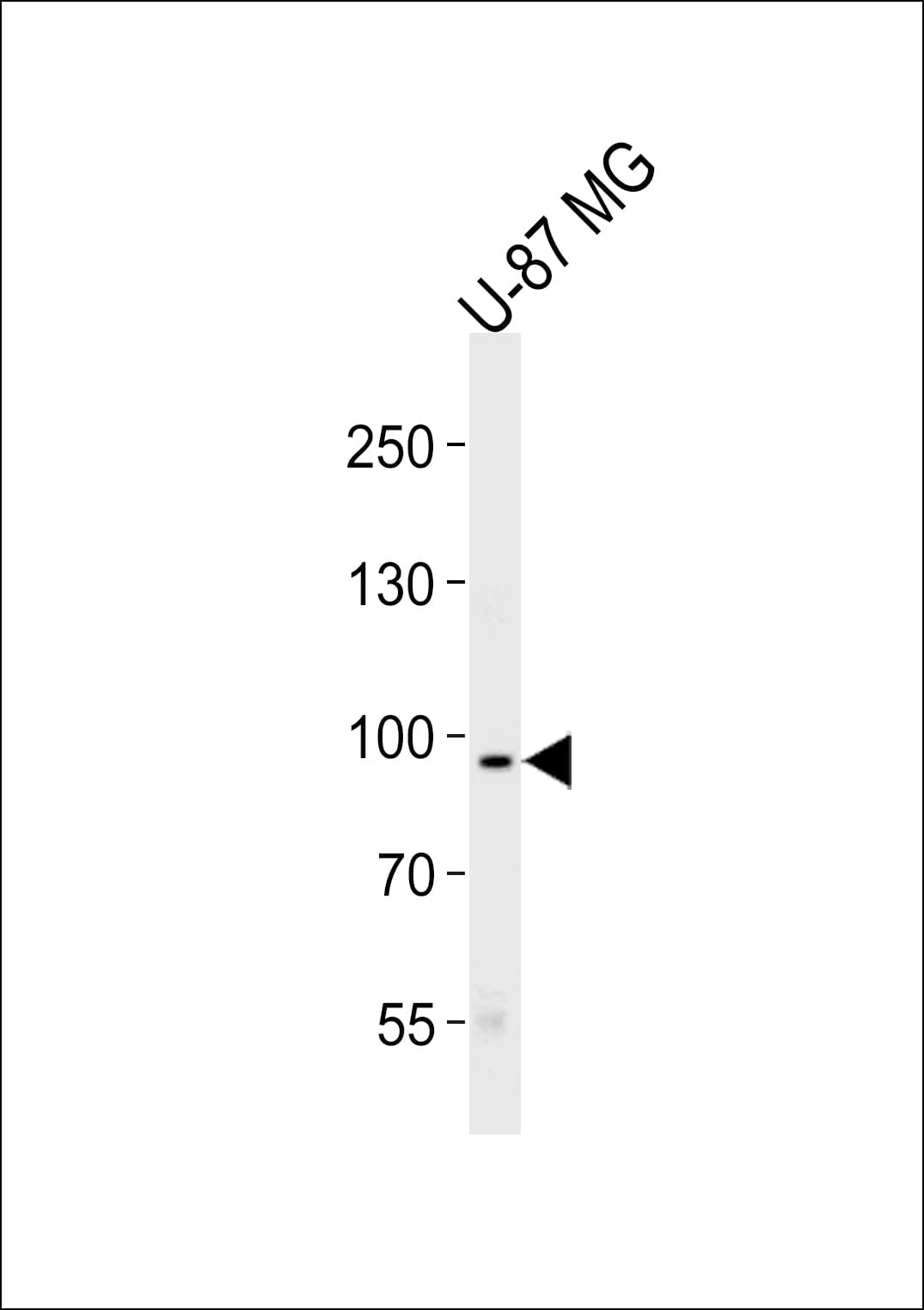 Polyclonal Rabbit anti-Human TYRO3 Antibody (IHC, WB)