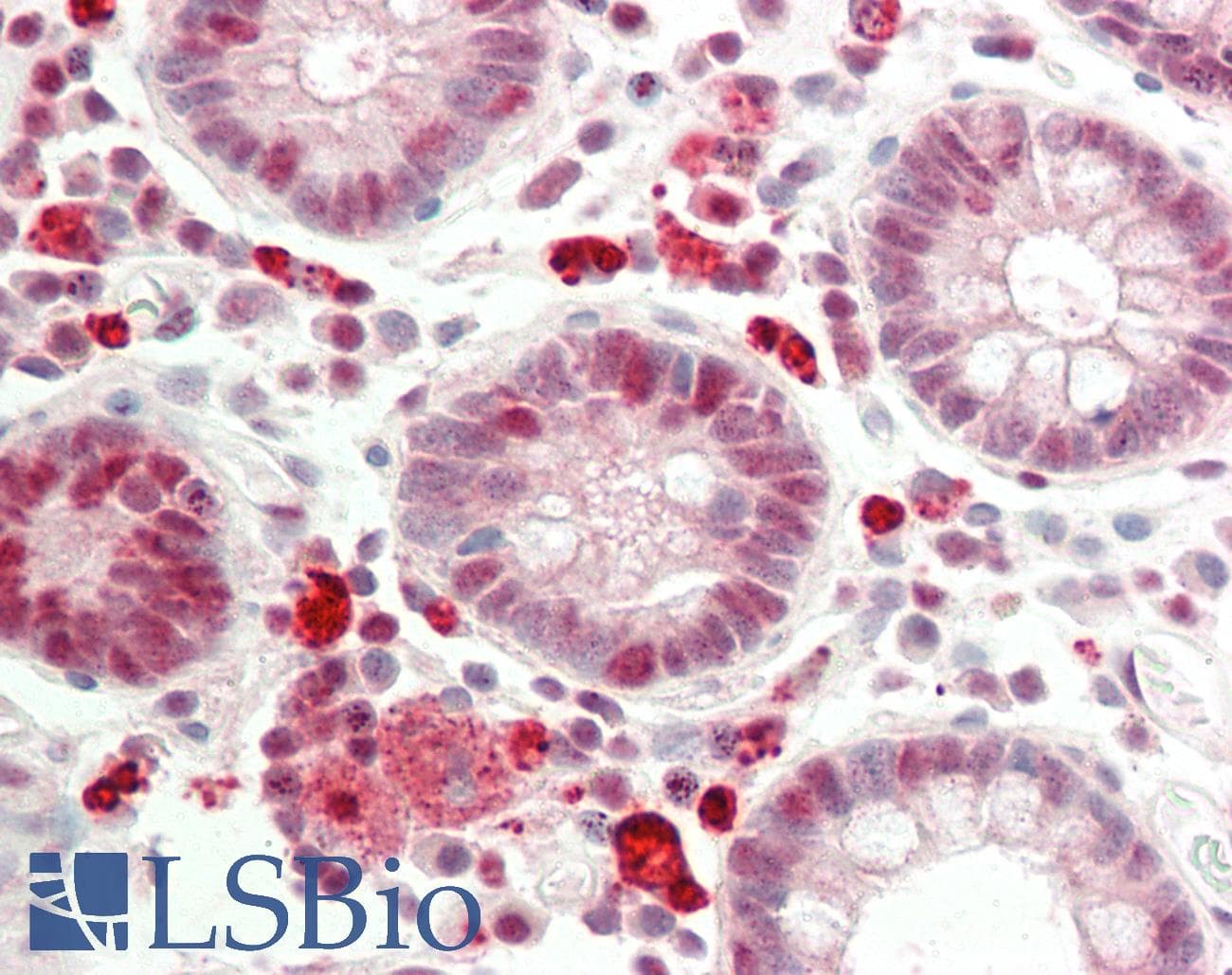 GSR / Glutathione Reductase Antibody (aa182-231)