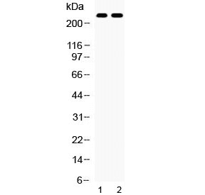 Polyclonal Rabbit anti-Mouse ABCA4 Antibody (WB)