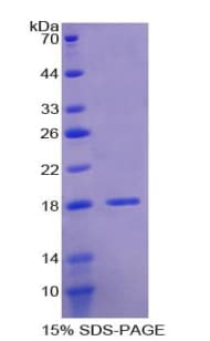 Human LOXL1 Protein (Recombinant His)