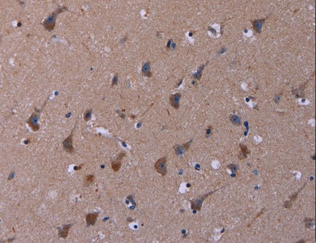 TUBGCP2 / GCP2 Antibody