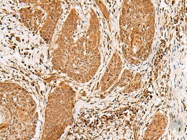 PPOX Antibody