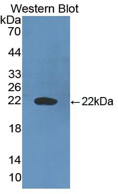 BAD Antibody (aa1-168, APC)