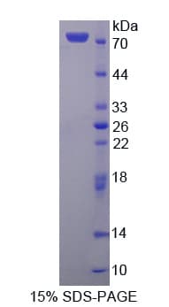 Human FDPS Protein (Recombinant His-GST)