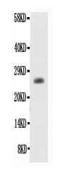 Polyclonal Rabbit anti-Human BCL2 / Bcl-2 Antibody (aa1-211, WB)