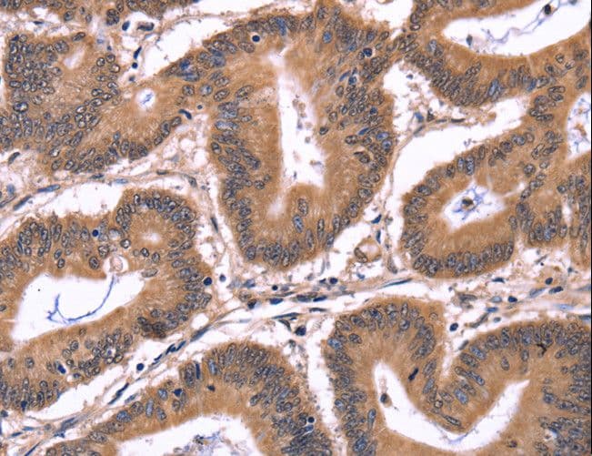 Polyclonal Rabbit anti-Human CRK Antibody (IHC)