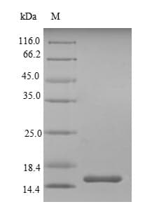 Mouse SIGIRR Protein (Recombinant 6His, N-terminus)