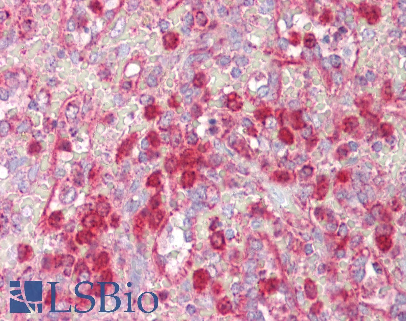 IHC-plus™ PIAS3 Antibody (aa10-59)