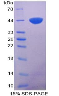 Chicken Calgizzarin / S100A11 Protein (Recombinant His-GST)