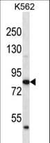 ABTB2 Antibody (aa681-710)
