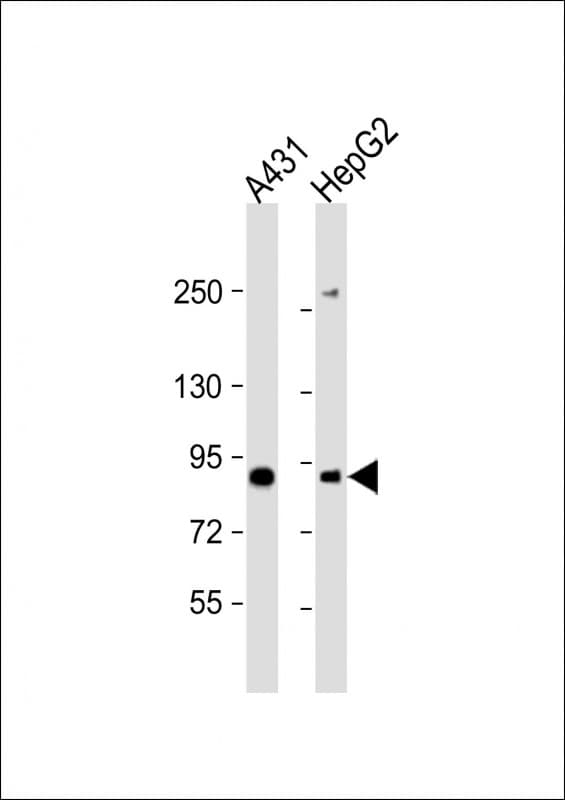 E2F8 Antibody (aa835-865)