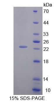 Human GADD45A / GADD45 Protein (Recombinant His-T7)