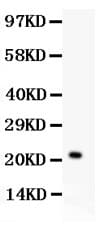 IL18 Antibody (aa36-192)