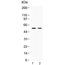Polyclonal Rabbit anti-Human ANGPTL2 / ARP2 Antibody (IHC, WB)