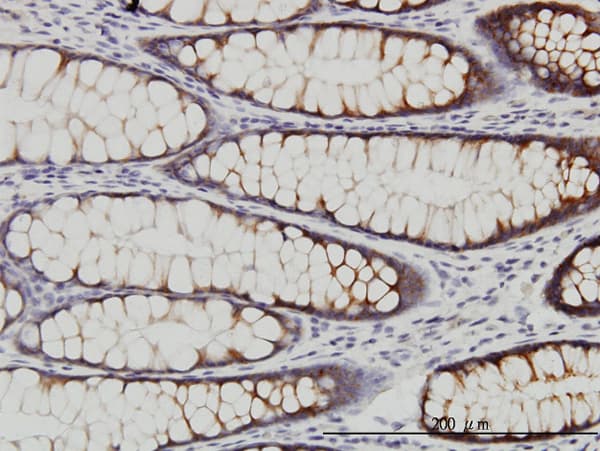 WNK2 Antibody (clone 2E10)