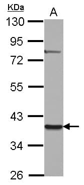 ZNF302 Antibody