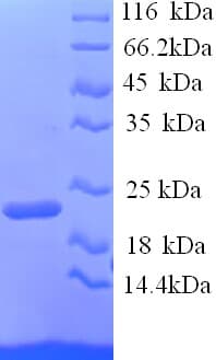 Mouse ITGAL / CD11a Protein (Recombinant His)