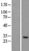 SRSF12 Protein (Over-Expression Lysate Myc-DDK (Flag))