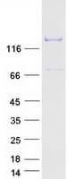 Human HELB Protein (Recombinant Myc-DDK (Flag))