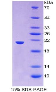 Human THOP1 / Thimet Oligopeptidase Protein (Recombinant His-T7)