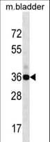 Polyclonal Rabbit anti-Human GIPC1 / GIPC Antibody (aa52-81, WB)