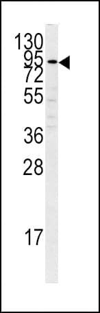 PLG / Plasmin / Plasminogen Antibody (aa636-665)